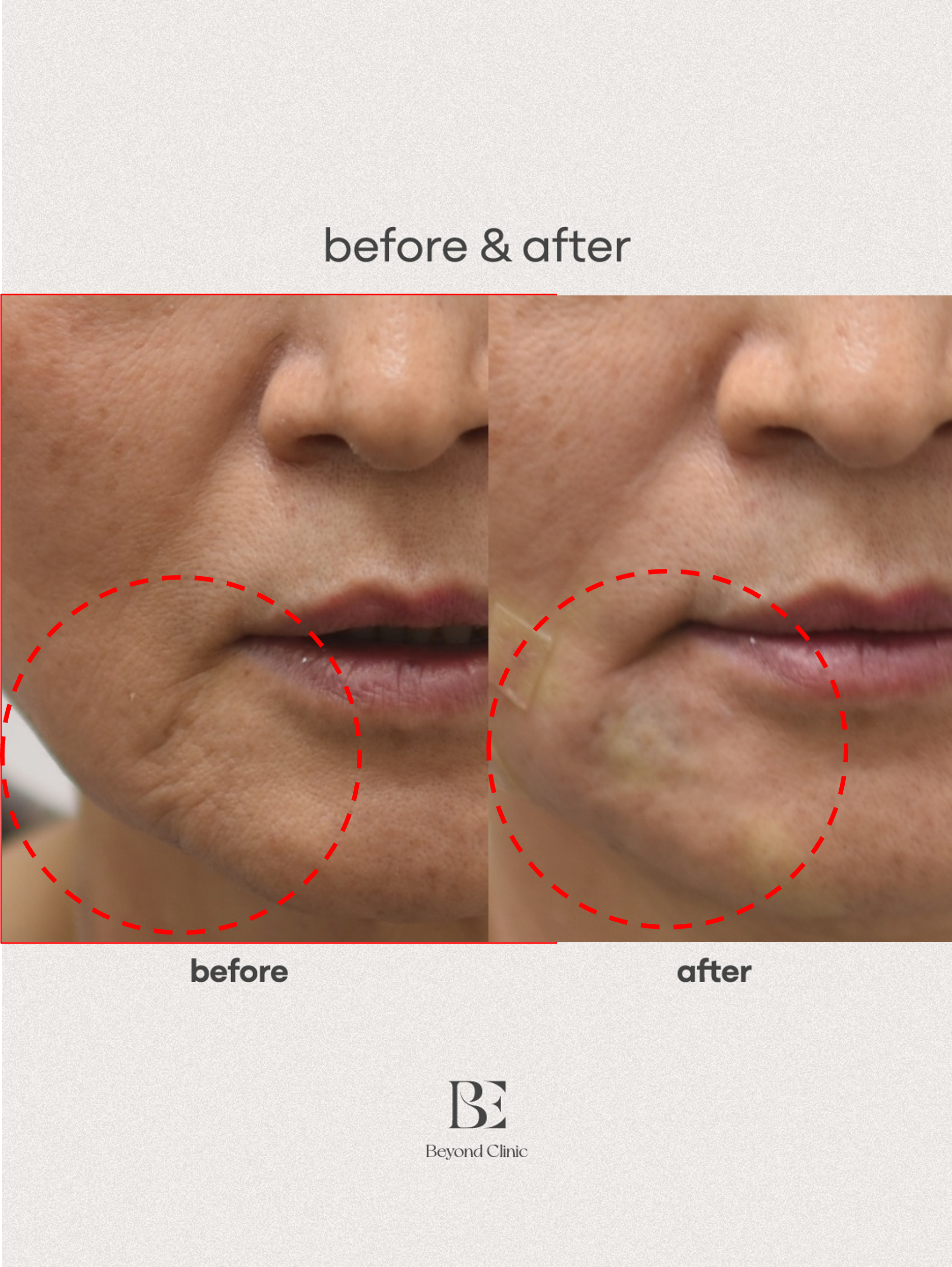 마리오네트 잼버실+레디어스