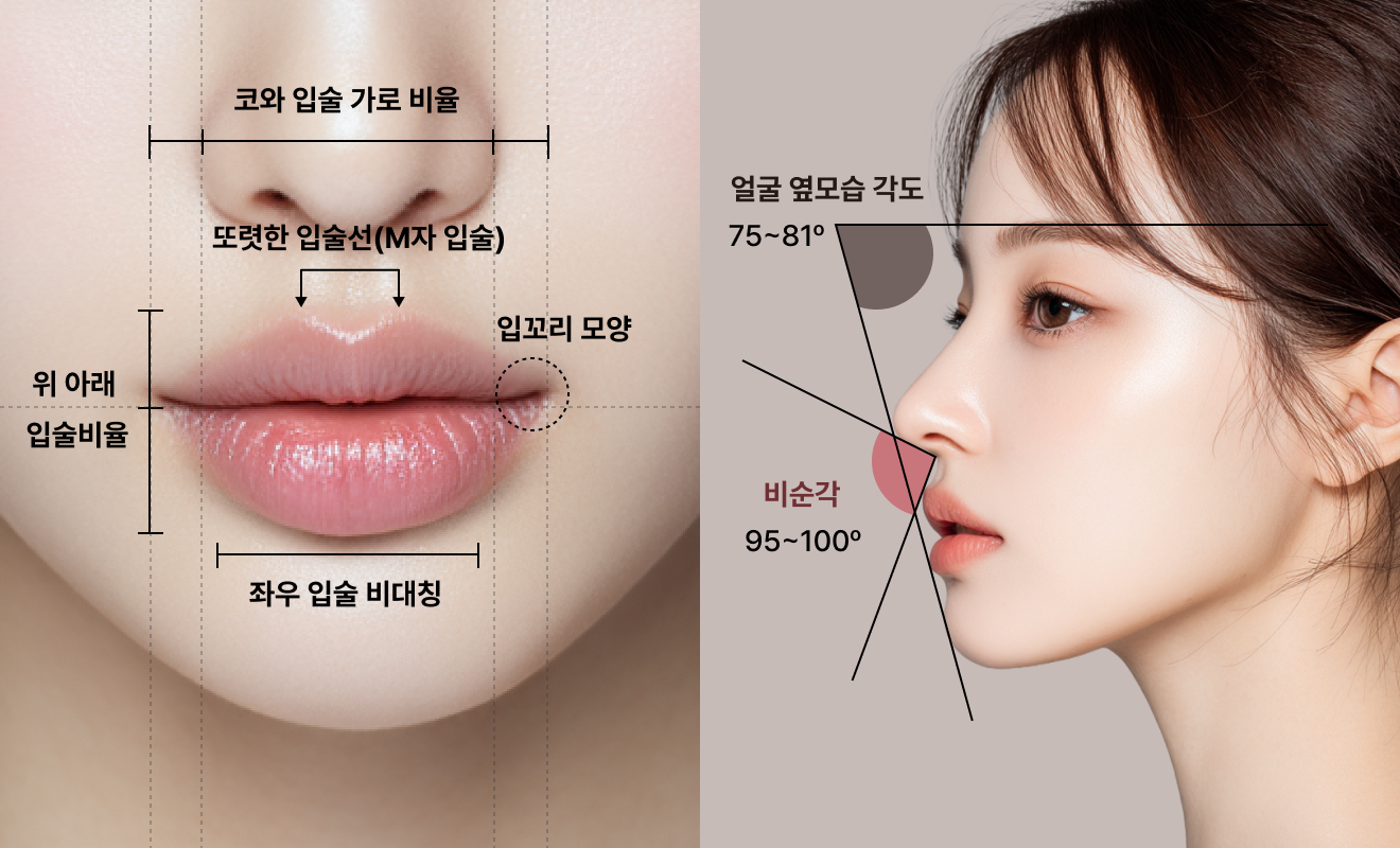입술 필러 (Lip Filler)